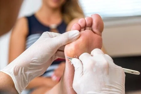 91101717_S_warts_podiatrist_woman_patient (1)